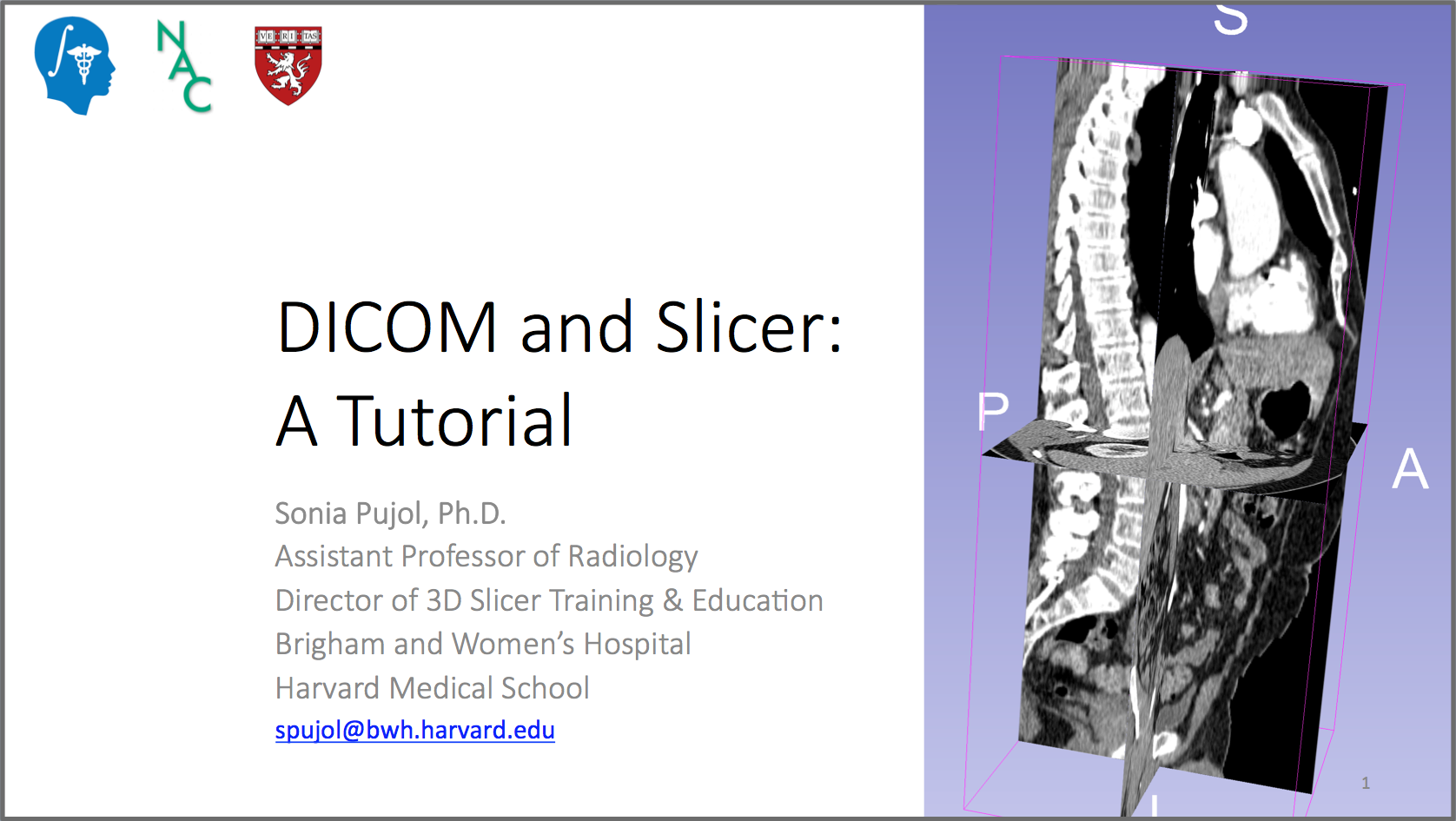 DICOM and Slicer