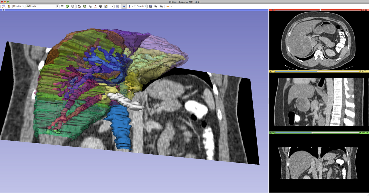 DICOM Image Visualization