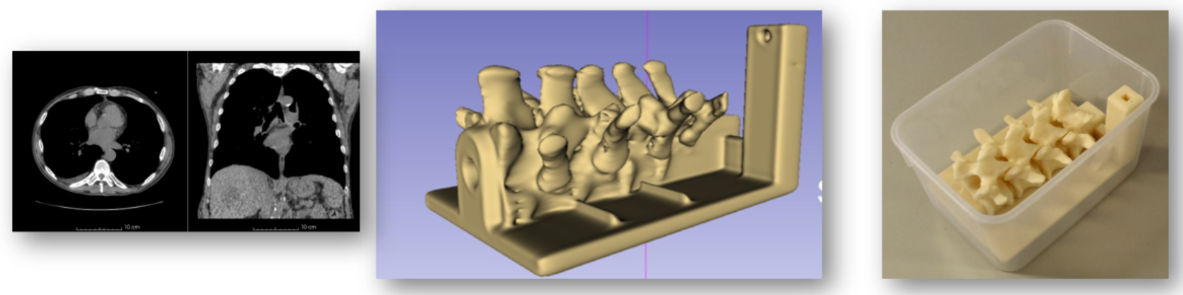 Segmentation for 3D Printing