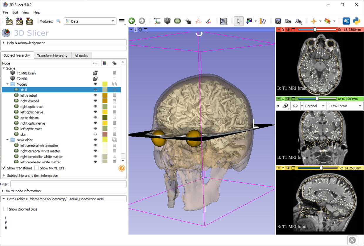 Data Loading and 3D Visualization